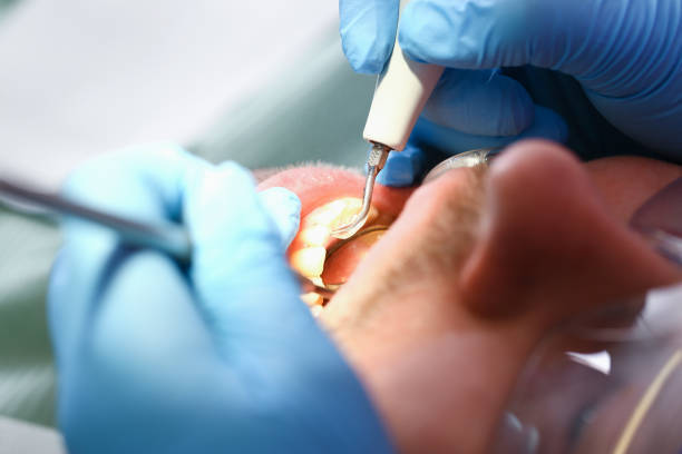 Best Urgent Care for Lost Fillings or Crowns in Nevada, TX