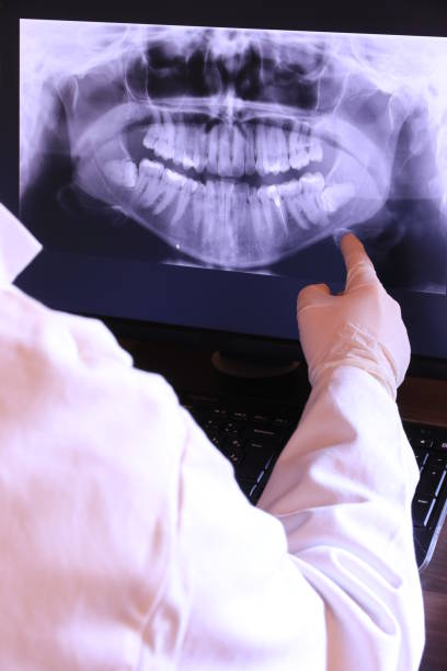 Best Emergency Gum Treatment in Nevada, TX