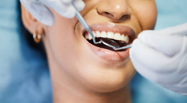 Best Emergency Dental Care for Broken or Chipped Teeth in Nevada, TX