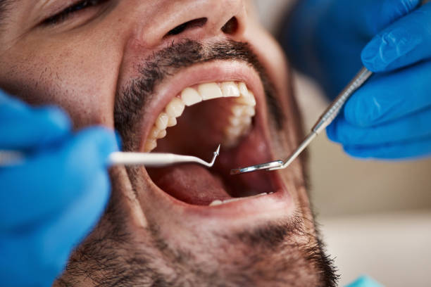 Best Same-Day Emergency Dental Services in Nevada, TX
